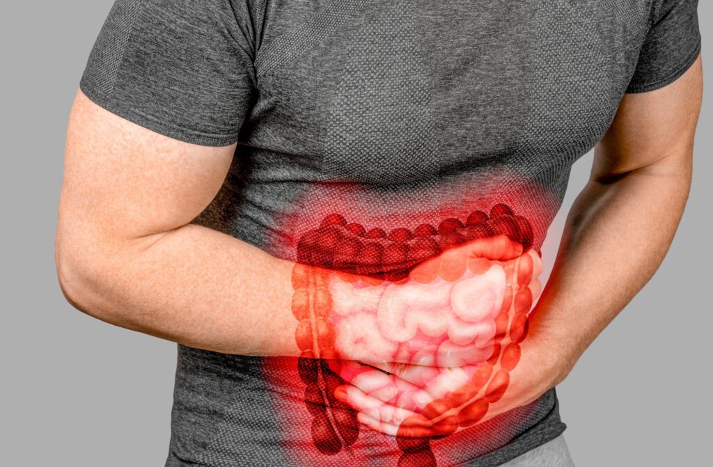 sindromul colonului iritabil