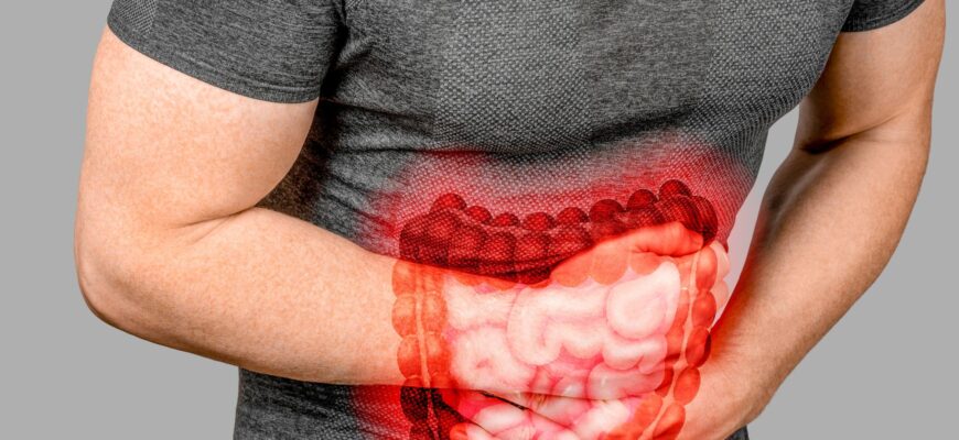 sindromul colonului iritabil