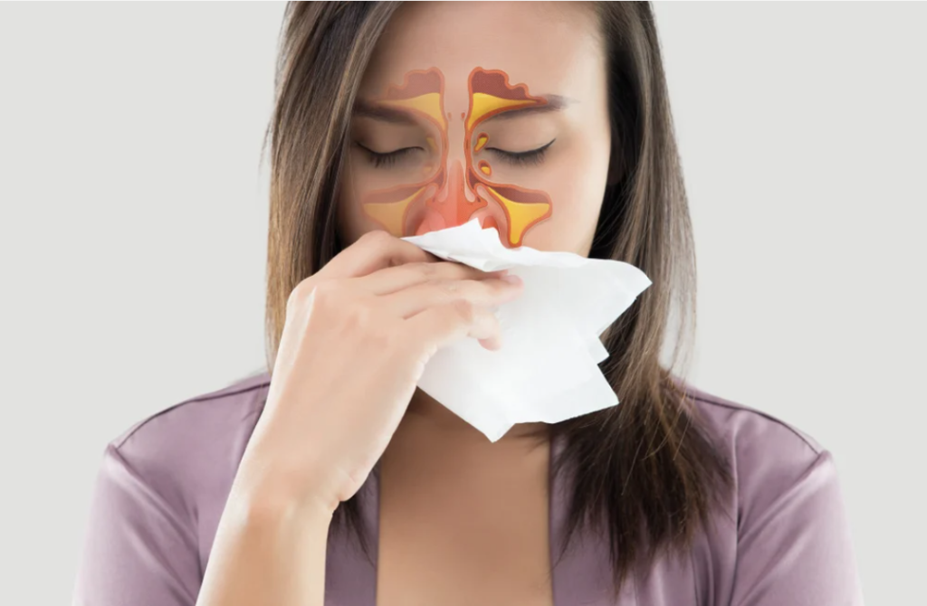 sinuzita poate fi clasificata in mai multe tipuri