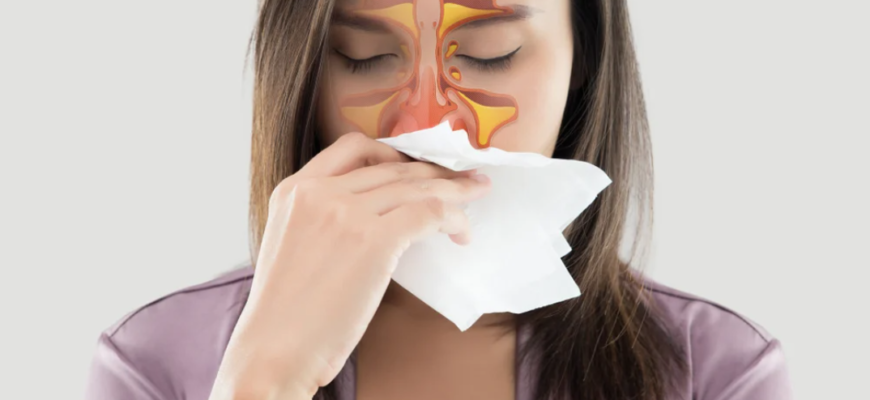 sinuzita poate fi clasificata in mai multe tipuri