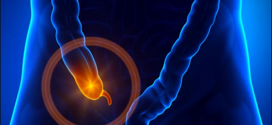 totul despre apendicita