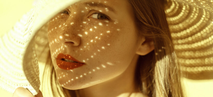 hiperpigmentarea pielii