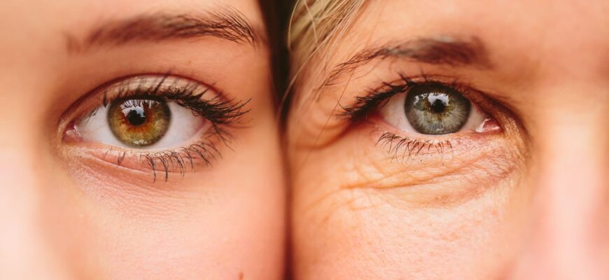 cauza a aparitiei ridurilor