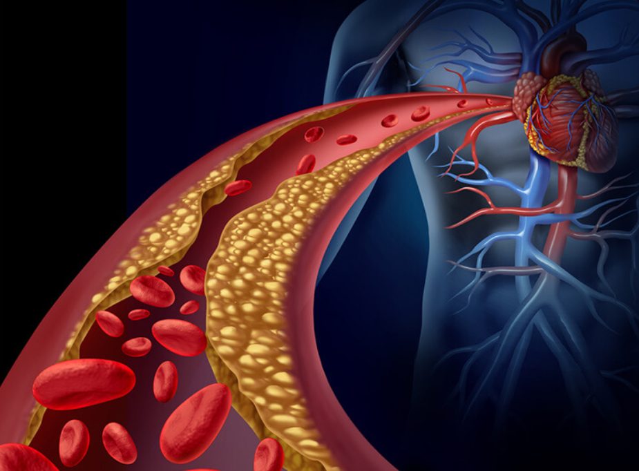 vitamina esentiala care curata arterele de grasimi