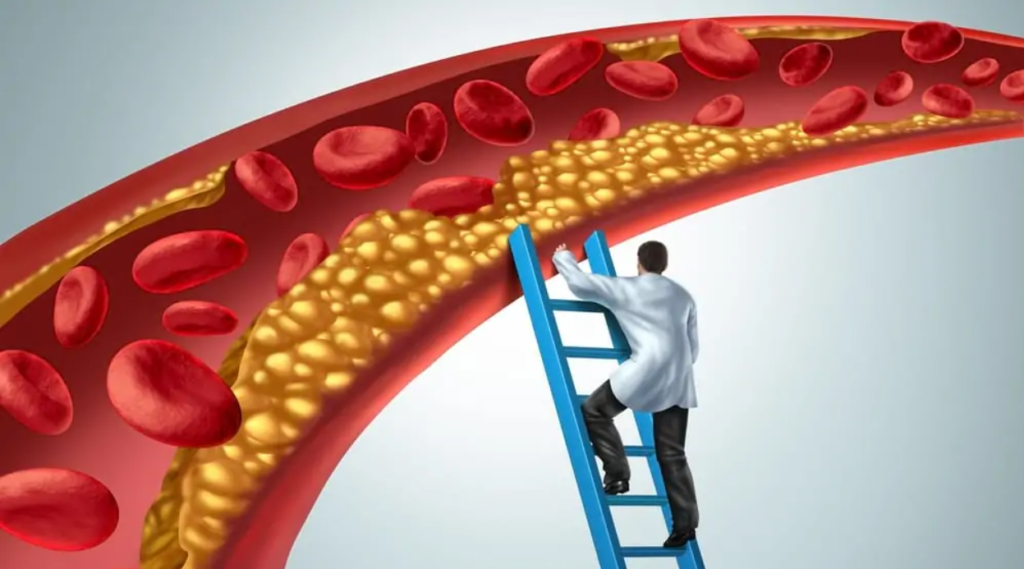 ce pericole ascunde colesterolul marit