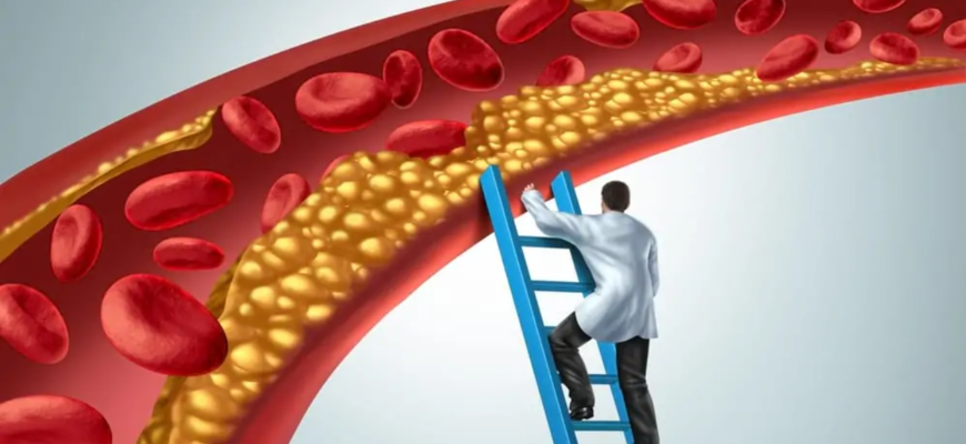 ce pericole ascunde colesterolul marit