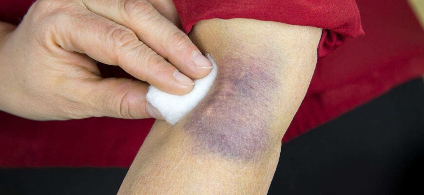 ce uleiuri pot contribui la tratare