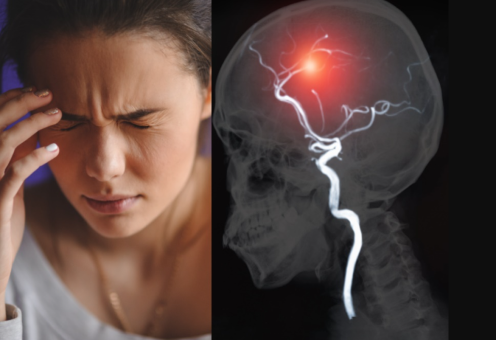 Accidentul ischemic tranzitor (AIT), avertisment serios pentru accidentul vascular cerebral (AVC). Diferențe și asemănări 1 accidentul ischemic tranzitor