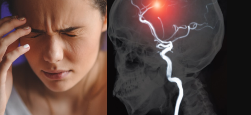 accidentul ischemic tranzitor