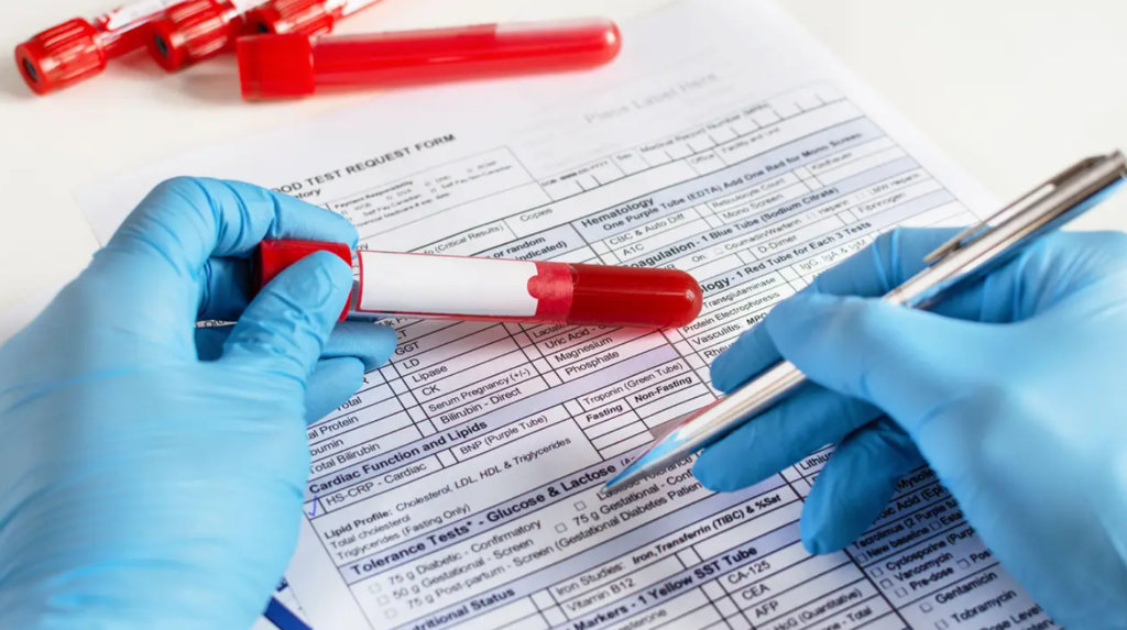 hemoglobina glicolizata