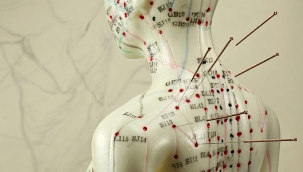 Acupunctura - cum acționează această terapie alternativă și când să recurgi la ea