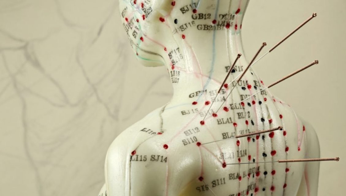 Acupunctura - cum acționează această terapie alternativă și când să recurgi la ea
