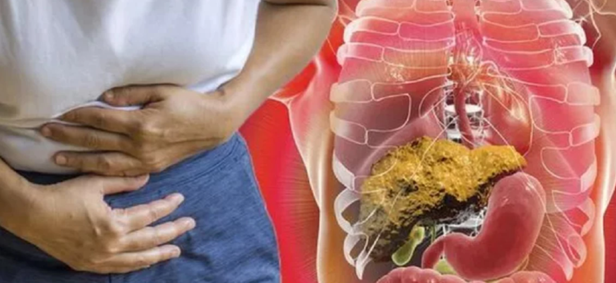 insuficienta hepatica