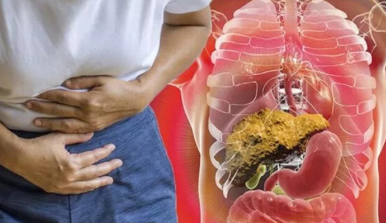 Ce este insuficiența hepatică. De ce apare și care sunt semnele revelatoare