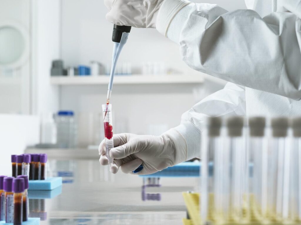 supraveghere a bolilor transmisibile