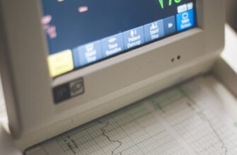 shallow focus of electrocardiogram