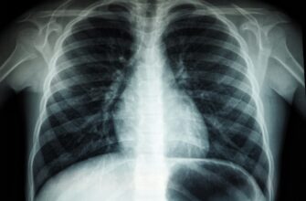 Peste 3000 de persoane din Republica Moldova au beneficiat de screening și prevenire a tuberculozei în 2025 7 black and white abstract painting