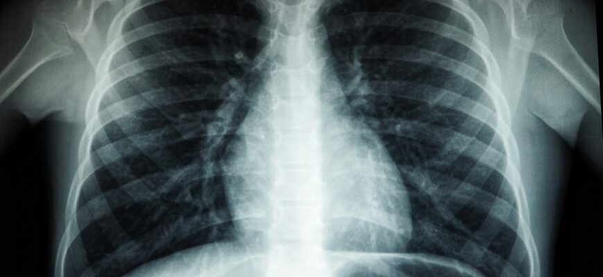 black and white abstract painting