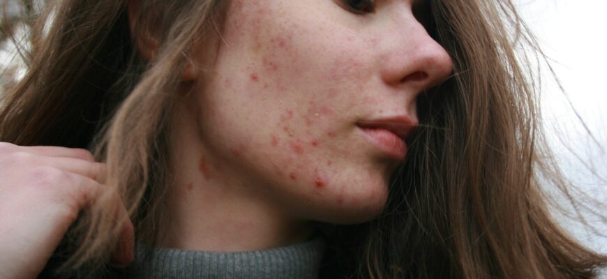 a woman with a substance on her face