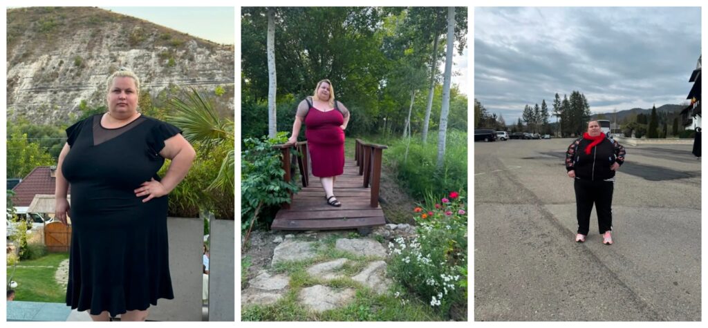 FOTO// Strigăt de ajutor din partea unei tinere mame din Orhei care crește singură un copil și luptă pentru viață: ”Am 186 kg și viața mea este în pericol” 3 befunky collage